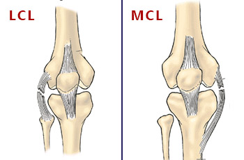 Knee Replacement Doctor In Jaipur